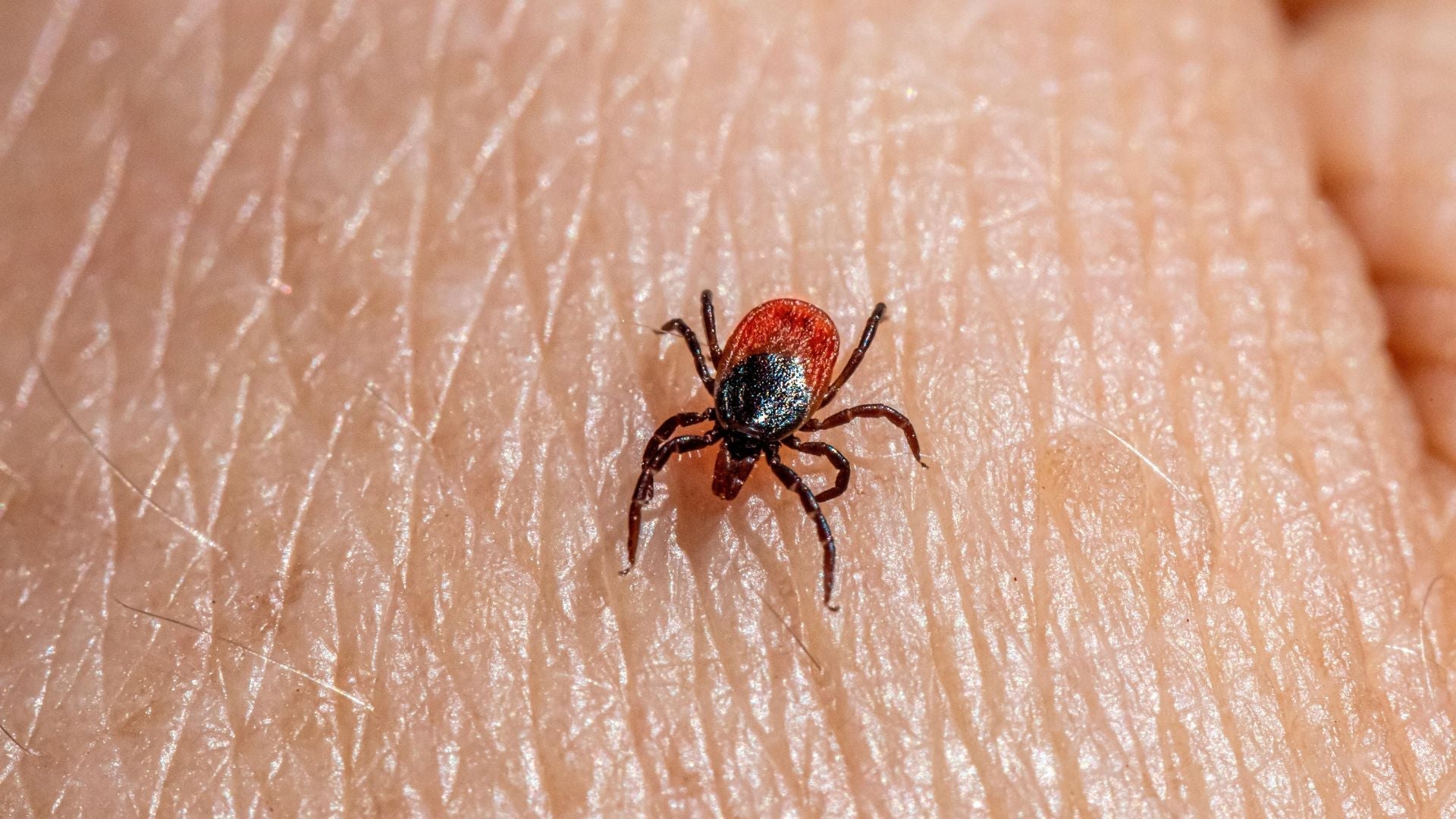 At-Home Lyme Disease Tests: Are They Accurate? What You Need to Know