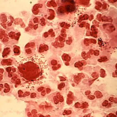 Vaginal