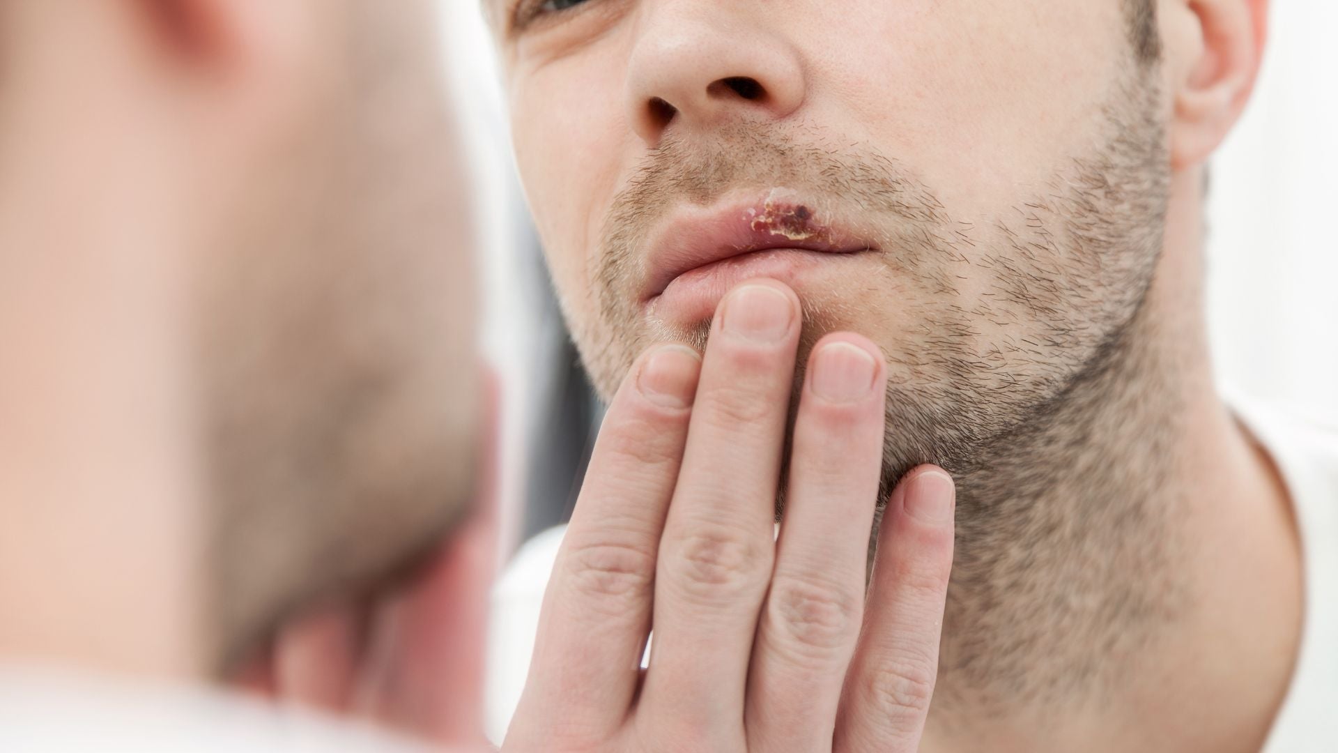 Codol Sore Do Cold Sores Mean I Have Herpes? - Learn More – Better Life Science