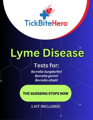 Lyme Disease Test